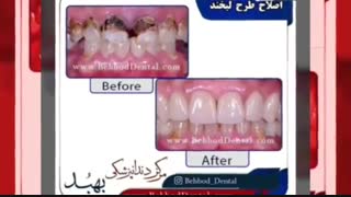 نمونه کارهای زیبایی و درمانی کلینیک دندانپزشکی بهبد