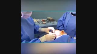 فیلم عمل لیفت صورت