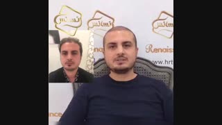 کاشت مو رنسانس - کلینیک تخصصی رنسانس لیزر فرکشنال