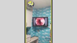 آندوسکوپی به علت گیر کردن غذا در گلو