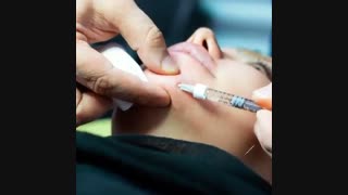 خدمات ارائه شده در بخش جراحی پلاستیک کلینیک توس