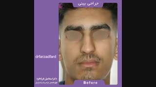 جراحی زیبایی بینی توسط دکتر فرزاد فرد کلینیک دندانپزشکی