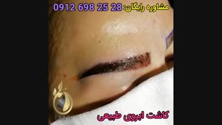 کاشت ابرو طبیعی | کلینیک لیان | 02188978829