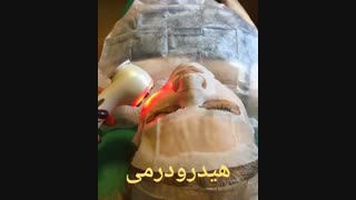 هیدرودرمی - 22807060