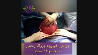 جراحی فیبروم رحم