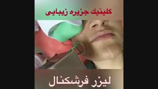 لیزر فرکشنال در کلینیک زیبایی جزیره زیبایی