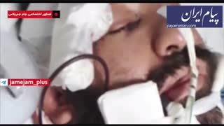 وضعیت هانی کرده پس از ۱۲ ساعت جراحی