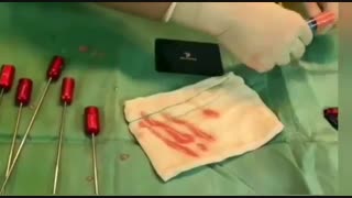 نانوفت بهترین و ایمن ترین جایگزین تزریق ژل و چربی پیلینگ شیمیایی