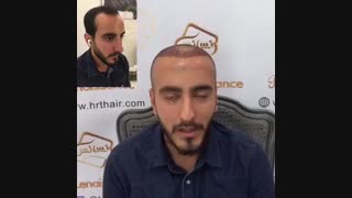 کاشت مو رنسانس - کلینیک تخصصی رنسانس درمان سلولیت
