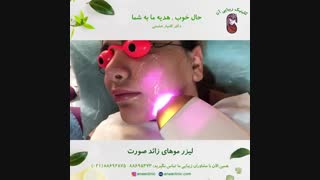 لیزر موهای زائد صورت - کلینیک زیبایی آنا