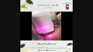 لیزر موهای زائد زیر بغل - کلینیک زیبایی آنا