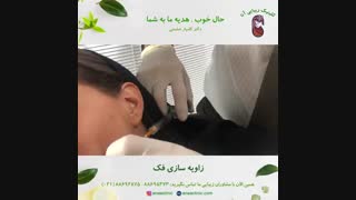 زاویه سازی فک - کلینیک زیبایی آنا