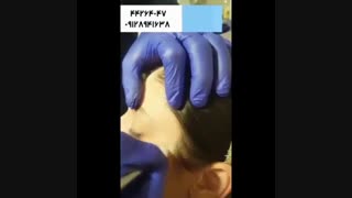 روش ترکیبی میکرودرم و پلاسما جت