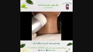جوانسازی و لیفت گردن با دستگاه آر اف - کلینیک زیبایی آنا