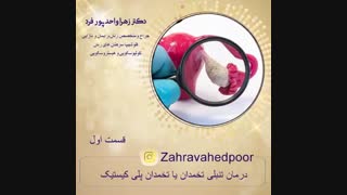 تنبلی تخمدان یا سندرم تخمدان پلی کیستیک