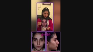 عمل بینی   در تهران