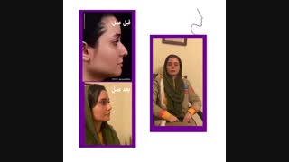 رضایت بیمار از جراحی بینی