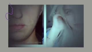 نمونه کار جراحی بینی