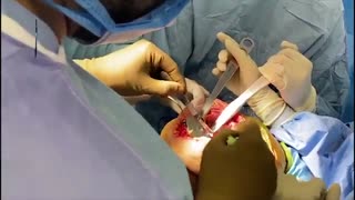 فیلم عمل جراحی تعویض مفصل زانوی دوطرفه پیچیده