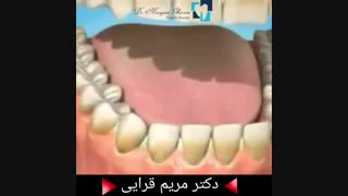 عوارض مصرف سیگار روی دندان