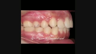 ارتودنسی شمال تهران | متخصص ارتودنسی