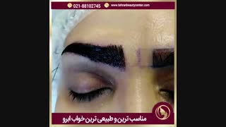 کاشت ابرو در مرکز زیبایی تهران (تهران بیوتی سنتر)