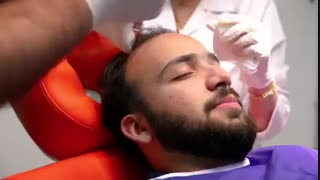 زراعة الشعر بطریقة مایکرو جرافت | عیادة هلیا | 982122810089+