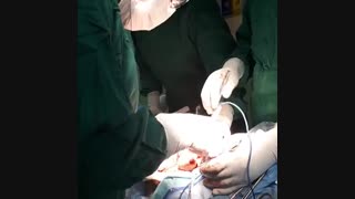 پوکی استخوان و شکستگی گردن فمور
