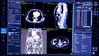 تیزرمرکز تصویربرداری پزشکی جام جم شهریار