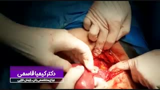 فیلم جراحی هیسترکتومى