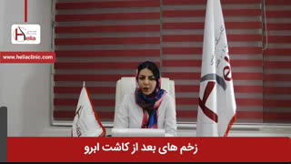 زخم های بعد از کاشت ابرو | کلینیک هلیا | 02122810089
