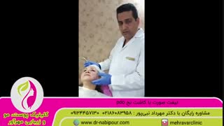 لیفت صورت با نخ pdo