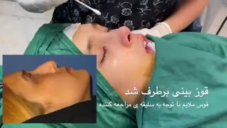 جراحی بینی نیمه فانتزی