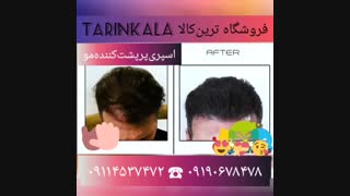 اسپری پرپشت کننده مو -09190678478 - بهترین اسپری پرپشت کننده موی سر