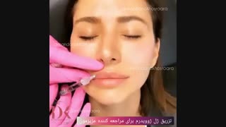 فیلم درمان افتادگی پلک بدون جراحی با پلاسما