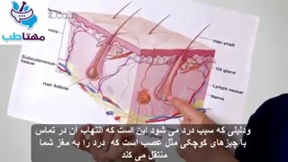 -677993550-تفاوت جوش و آکنه کیستی