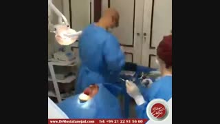 جراحی ایمپلنت | دکتر اشکان مصطفی نژاد
