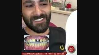 اصلاح طرح لبخند | دکتر اشکان مصطفی نژاد