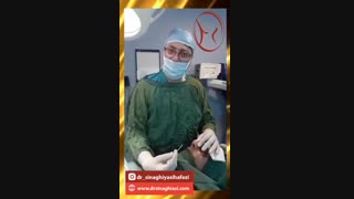 عمل بینی در آقایان