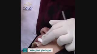 ساخت طرح لبخند