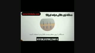 انواع لیزر آقایان و بانوان  09120132883  -  مشخصات  قیمت فروش مدل های لیزر موی زائد بدن