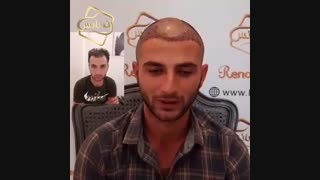 تکنیک سوپر کاشت کلینیک رنسانس- 02122088210