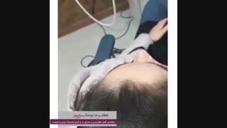 نتیجه جراحی بینی بعد از 5 ماه