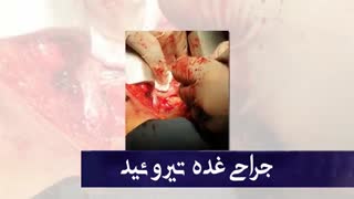 جراحی غده تیروئید