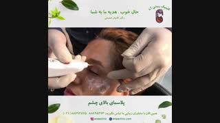 پلاسمای بالای چشم - کلینیک زیبایی آنا