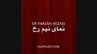 جراحی بینی به روش بسته