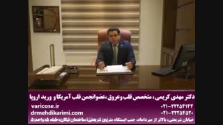 واریس چیست؟