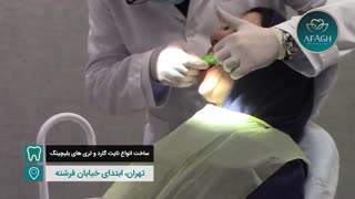ساخت انواع نایت گارد و تری های بلیچینگ
