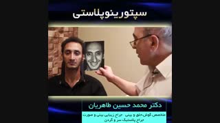 سپتورینوپلاستی