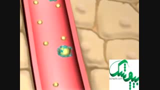 عوارض کلسترول بالای خون چیست؟ درمان یا کاهش کلسترول خون بالا - بیچشک